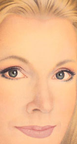 Blepharoplasty After Surgery