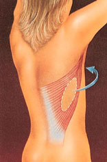 breast_reconstruction-4