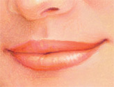 injectable_fillers-5
