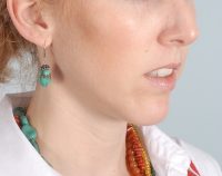 Chin Advancement