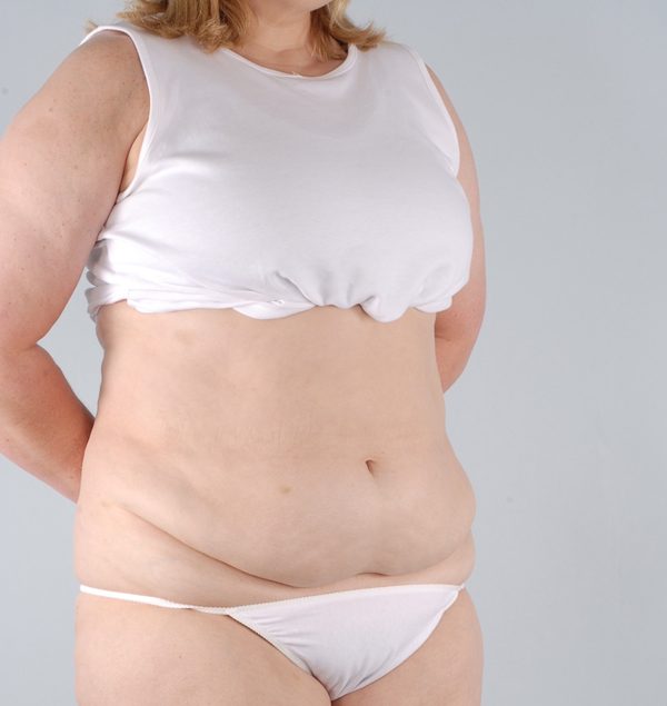 Abdominoplasty (Tummy Tuck)