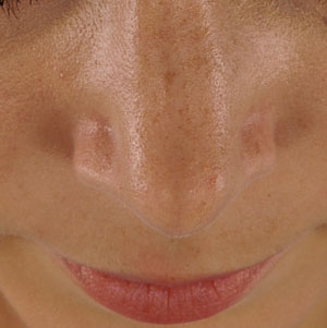 Tip Case 2606 After Photo Tip