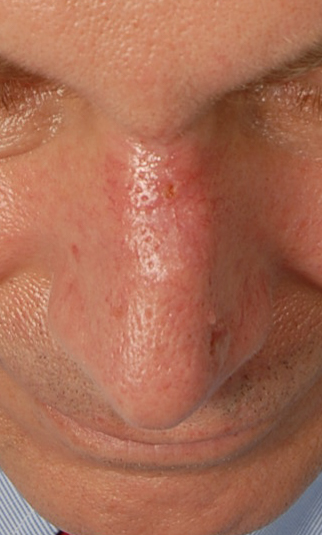 Facial Reconstruction Case 2769 After Photo Facial Reconstruction