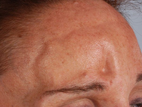 Facial Reconstruction Case 2771 Before Photo Facial Reconstruction
