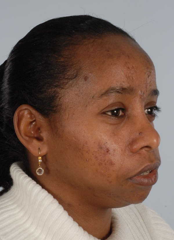 Facial Reconstruction Case 2781 Before Photo Facial Reconstruction
