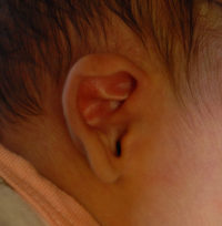 Ear Molding