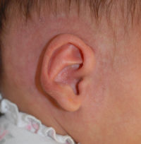 Ear Molding