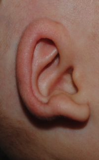 Ear Molding