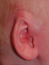 Ear Molding