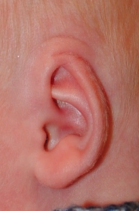 Ear Molding