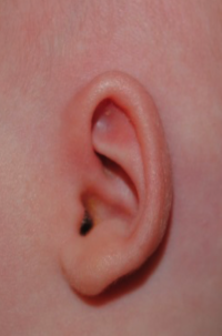 Ear Molding