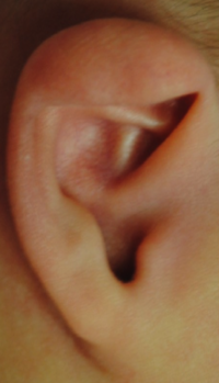 Ear Molding