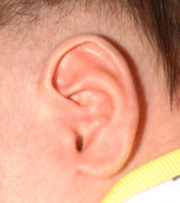 Ear Molding