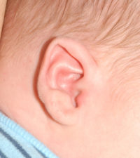 Ear Molding