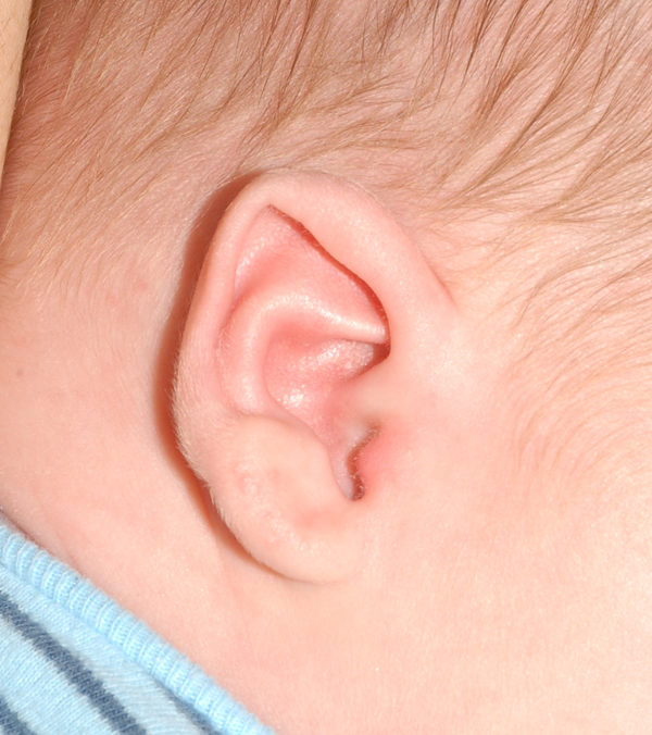 Ear Molding