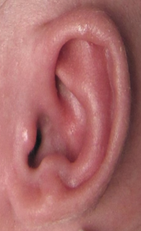 Ear Molding