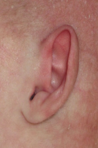 Ear Molding