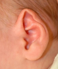 Ear Molding