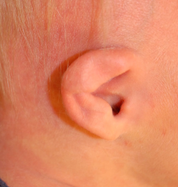 Ear Molding