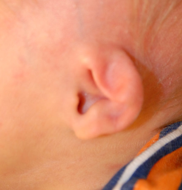 Ear Molding