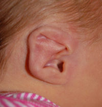 Ear Molding