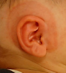 Ear Molding