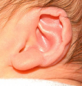 Ear Molding