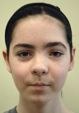 Facial Reconstruction Results Washington