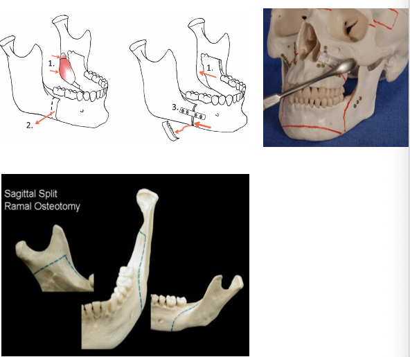 jaw-sugery-surgeon