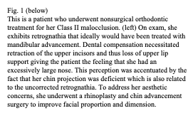 jaw-sugery-surgeon