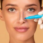 A woman undergoing a nose lining procedure for rhinoplasty with Dr. Stephen. Baker
