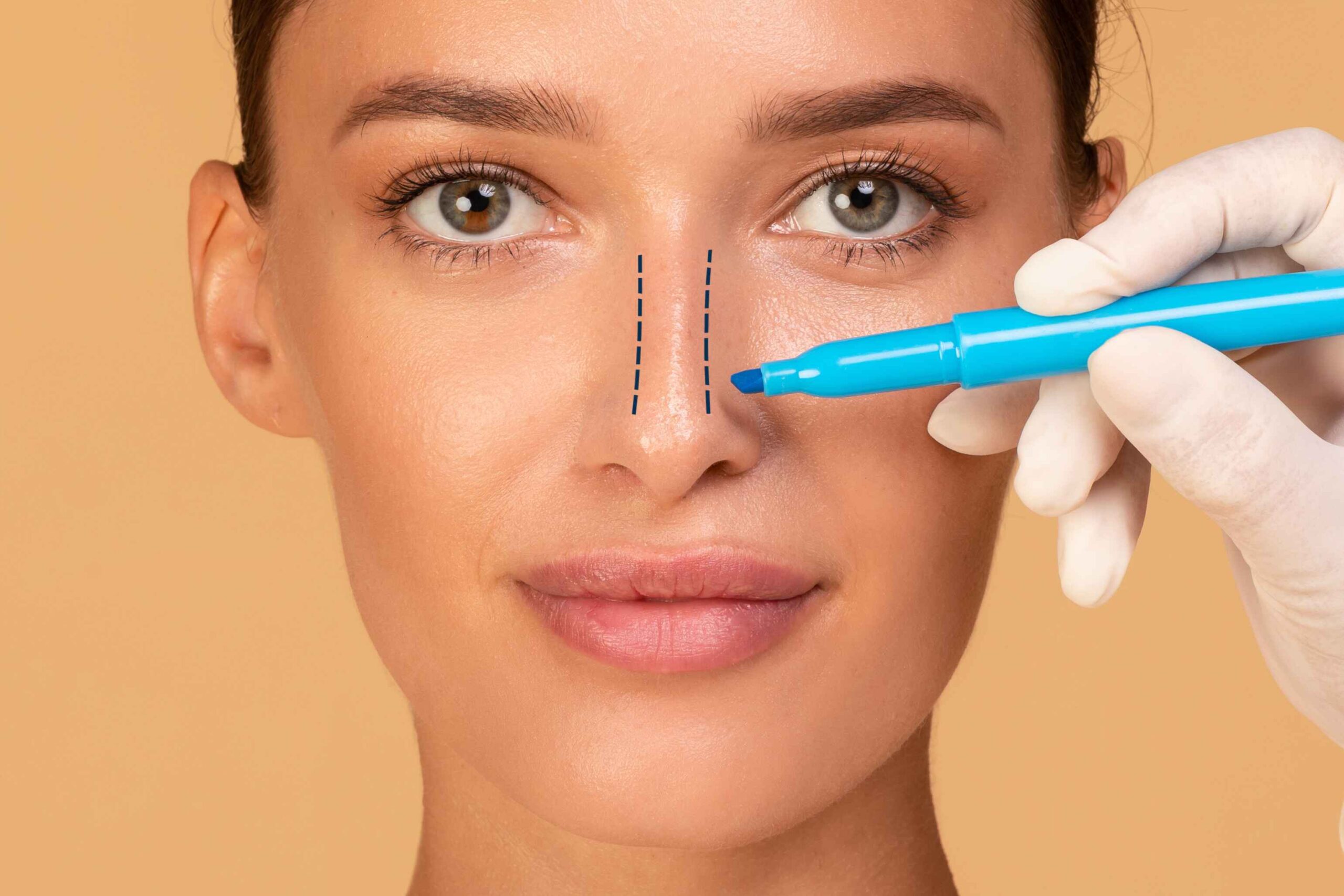 A woman undergoing a nose lining procedure for rhinoplasty with Dr. Stephen. Baker